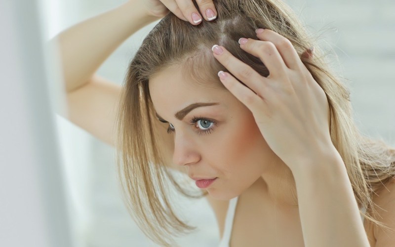 Healthy Choices that Can Help to Prevent Hair Loss